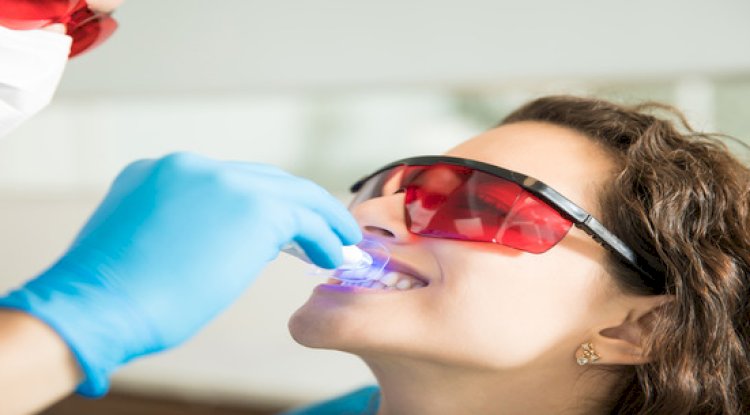 Top 5 Reasons to Choose Professional Teeth Whitening Over Store-Bought Kits