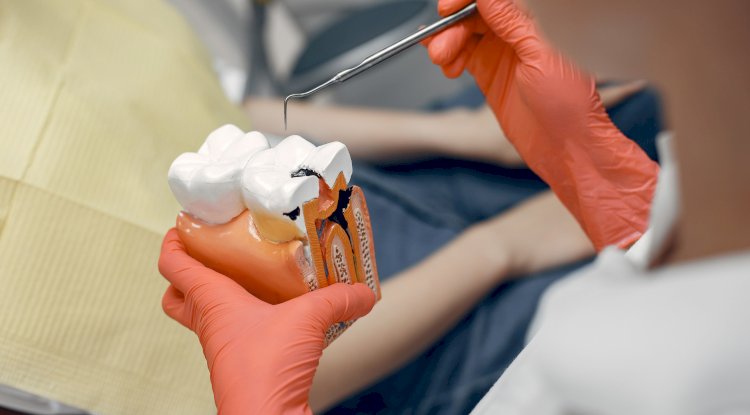 Say Goodbye to Tooth Pain: Get the Best Root Canal Treatment in Delhi