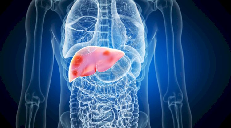 Comprehensive Liver Health Checkups by a Best Liver Doctor in Dubai
