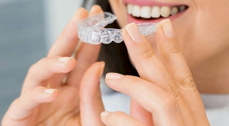 How Invisalign Works: The Step-by-Step Process Explained
