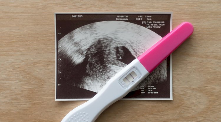 Early Pregnancy Scan: An Ultimate Guide