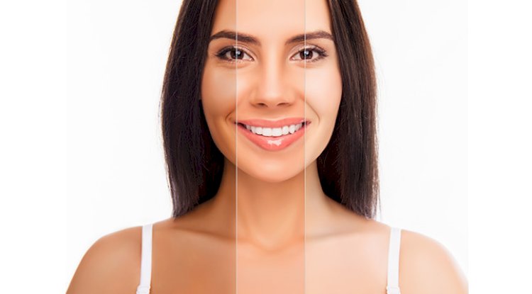 Comparing Popular Whitening Brands Used in Islamabad