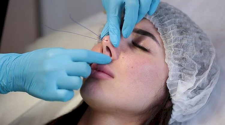 Is Non-Surgical Rhinoplasty Worth It Long-Term?