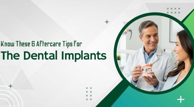Know These 6 Aftercare Tips for the Dental Implants