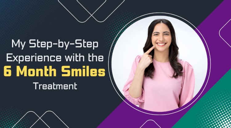 My Step-by-Step Experience with the 6 Month Smiles Treatment