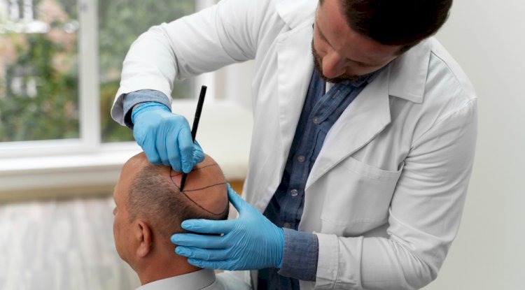 How a Hair Transplant Differs from Other Hair Restoration