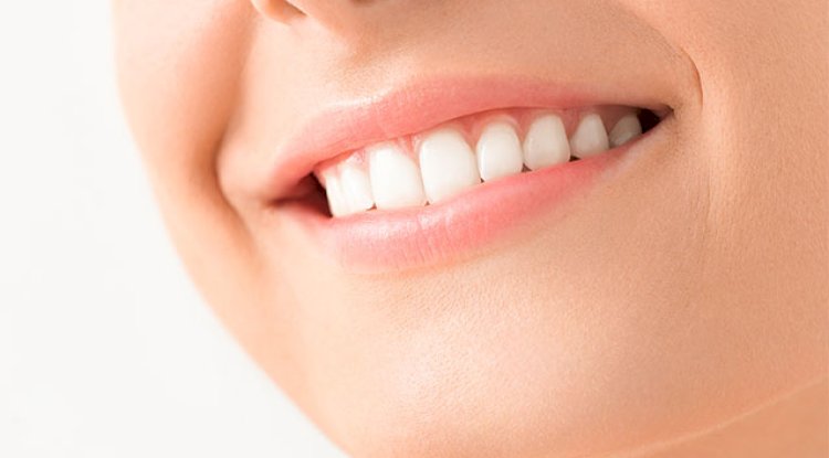 How Teeth Whitening Cost Matches Expectations