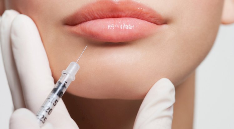 Are Lip Fillers Permanent?
