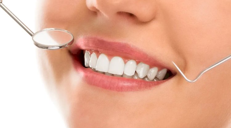 Teeth Whitening Treatments That Work in Dubai