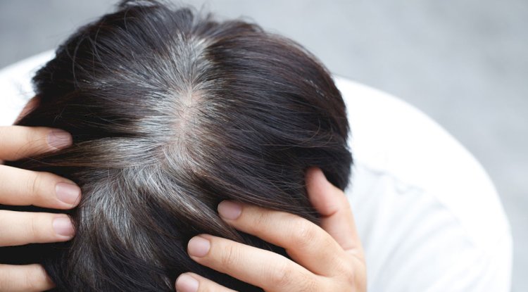 Can White Hair Be Removed on Dark Skin?