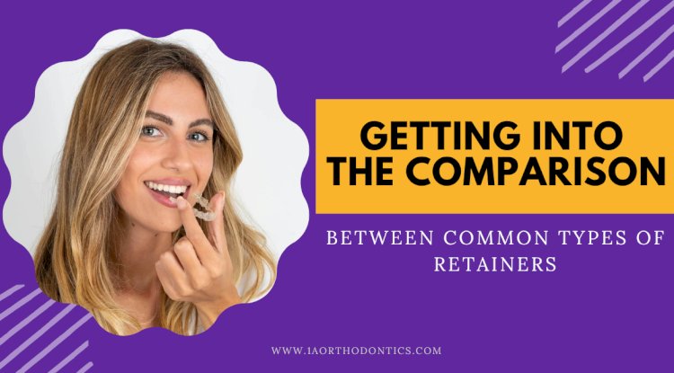Getting into the Comparison Between Common Types of Retainers