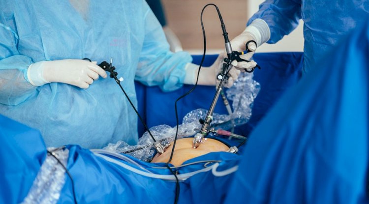 Best Doctor for Laparoscopic Surgery in Indore | Safe, Advanced, and Patient-Centered Care