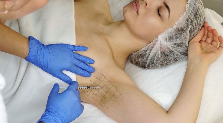 Is Underarms Botox a Permanent Sweating Solution?