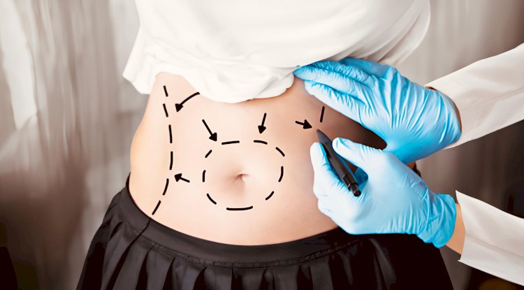 Bariatric Surgery Safety: What Patients Must Know Today