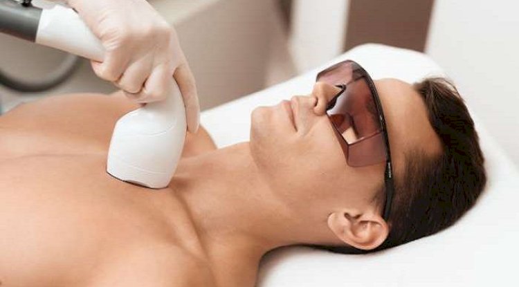 Can Men Use Laser Hair Removal Without Breaking Islamic Rules?