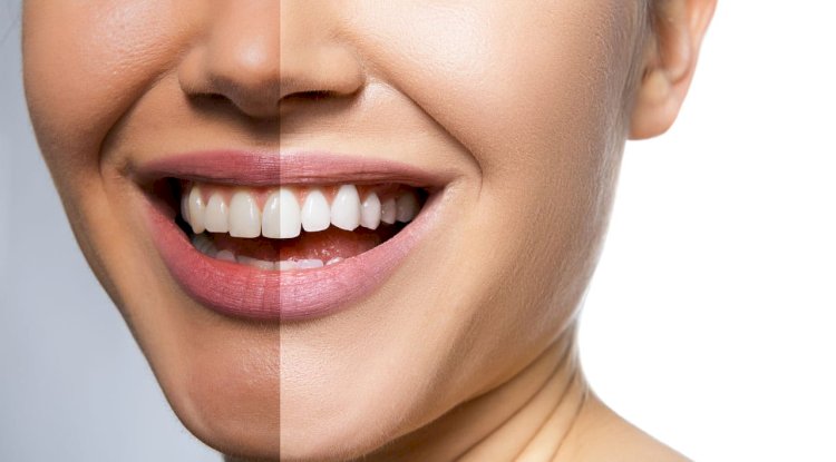Complete Family Dental Care in Toronto: Your Smile Deserves the Best