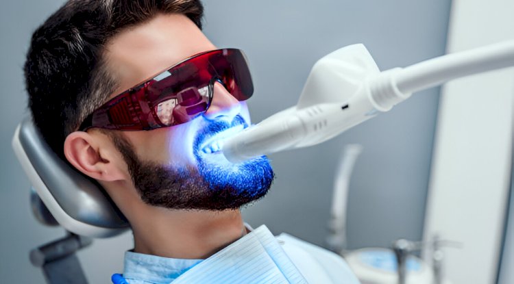 The Benefits of Teeth Whitening for A Radiant Smile in Killeen, TX