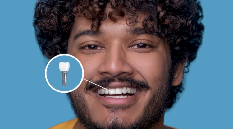Missing Teeth? Here’s Why Dental Implants Might Be Your Best Option