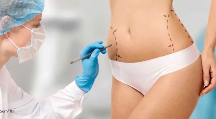 Why Choosing the Best Fat Transfer Surgeons in Dubai Matters for Results