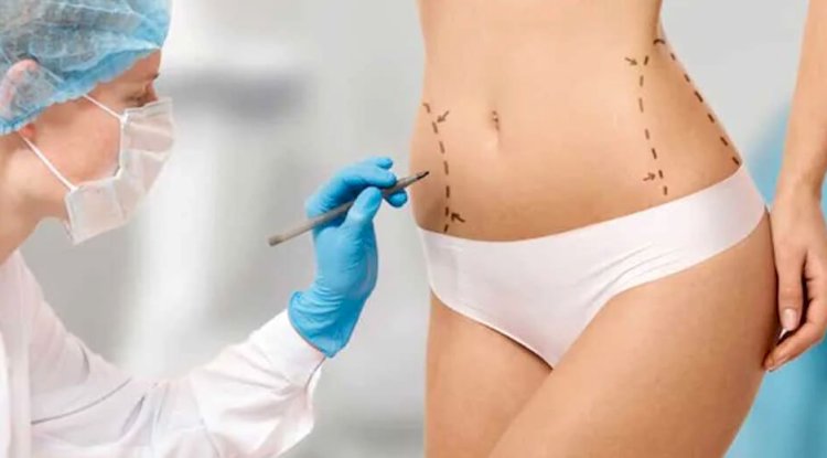The Truth About Liposuction in Islamabad