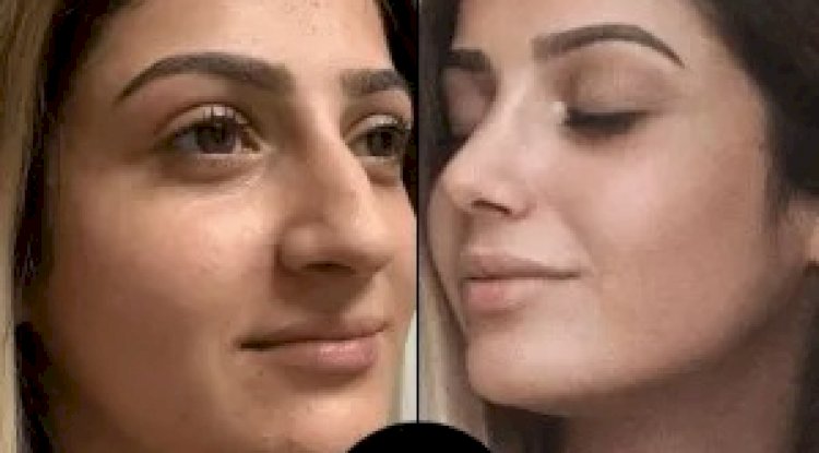 What Happened When I Visited the Best Aesthetic Clinic in Dubai