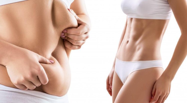 Essential Advice from the Best Liposuction Surgeon in Dubai