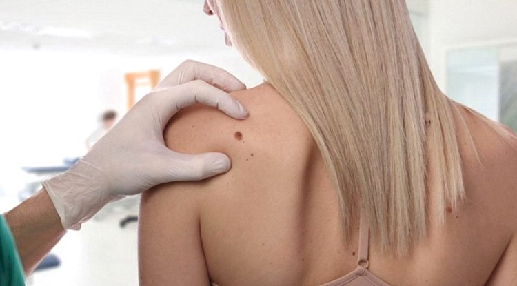 Fresh Start with Tag Removal Dubai