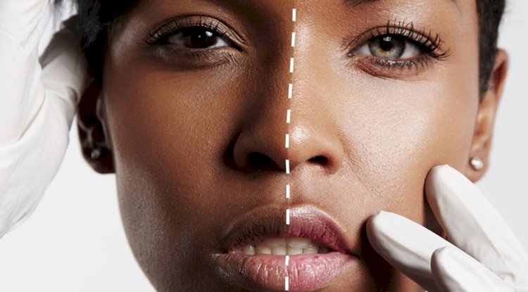 Skin Whitening in Islamabad: Cultural and Religious Considerations