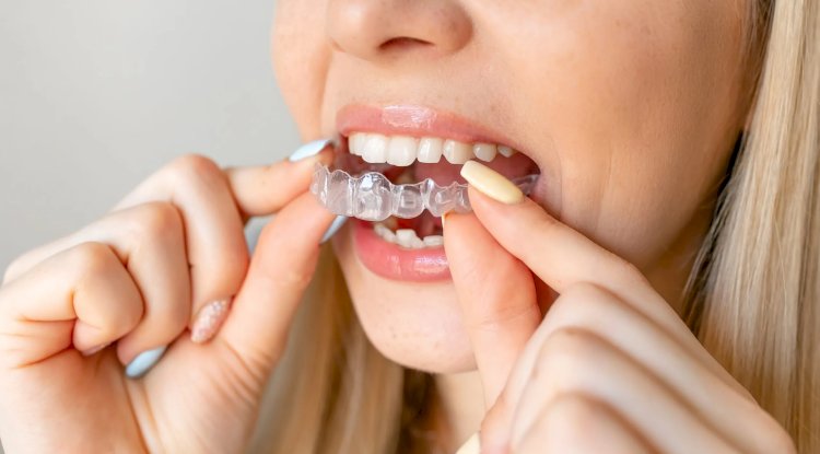 Invisalign Braces Treatment: Tracking Progress Effectively
