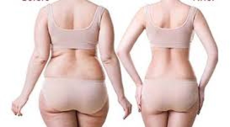 Sculpt Your Best You: Expert Body Contouring, Liposuction & 6-Pack Abs Surgery in Gurgaon