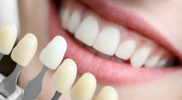 Top 10 Teeth Whitening Ingredients Ranked by Safety & Effectiveness