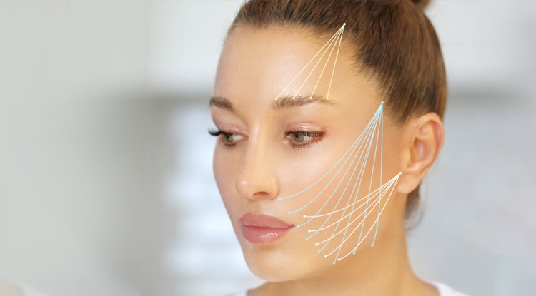 What to Expect Before, During, and After a Thread Lift Treatment in Dubai