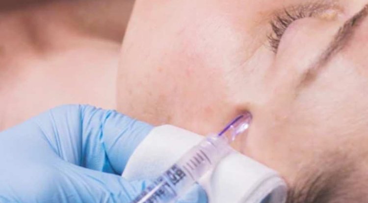 How Long Does Mesotherapy Last? A Complete Guide