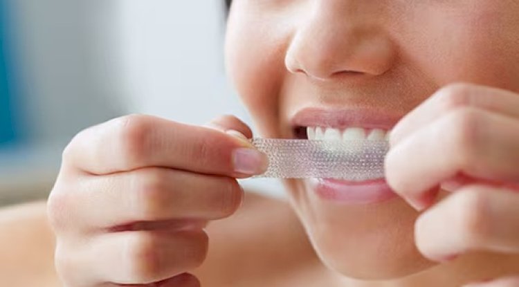 Smile Brighter Every Day: The Power of Crest 3D Whitestrips