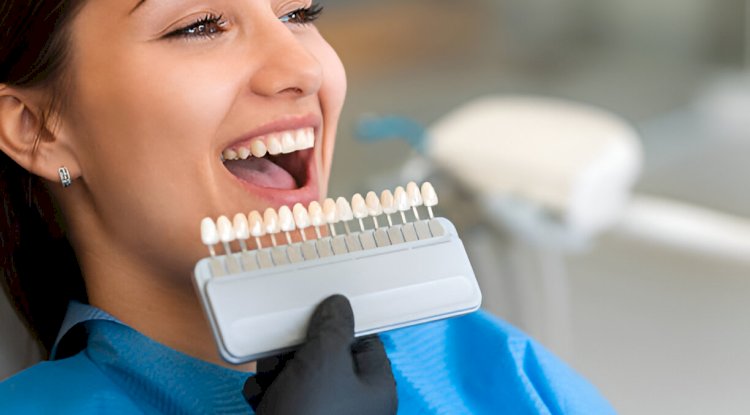 Maintaining Your Veneers: Tips from a New Albany, MS Dental Expert