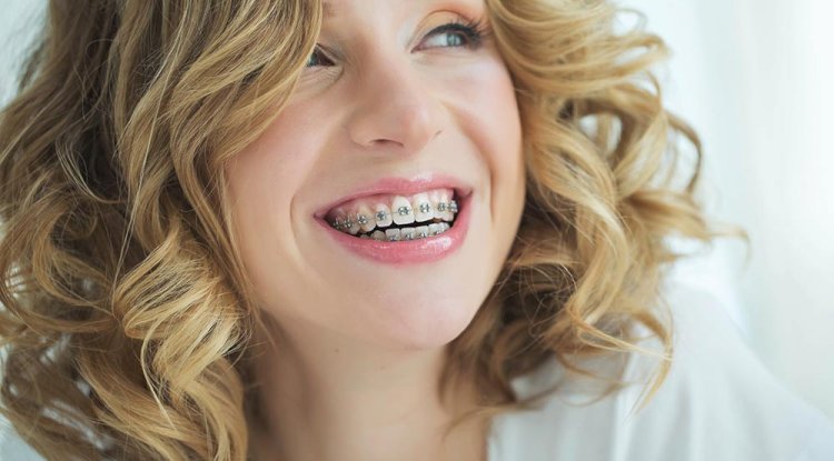 How Do Invisalign and Braces Orthodontics Compare for Treatment?