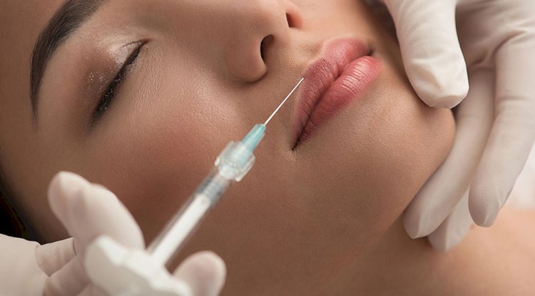 Can Lip Filler Injections Enhance Lip Definition Subtly?
