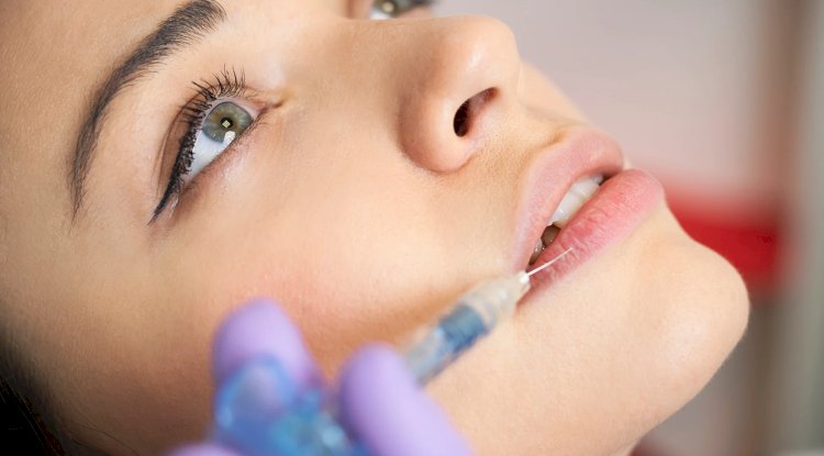 What Is Hyaluronic Acid and Why Is It Used in Lip Injections?