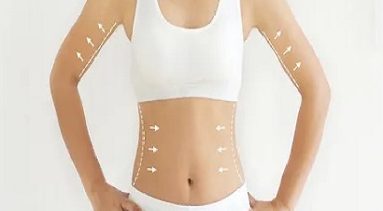 Body Contouring in Aesthetic Medicine: Safety, Efficacy, and Best Practices