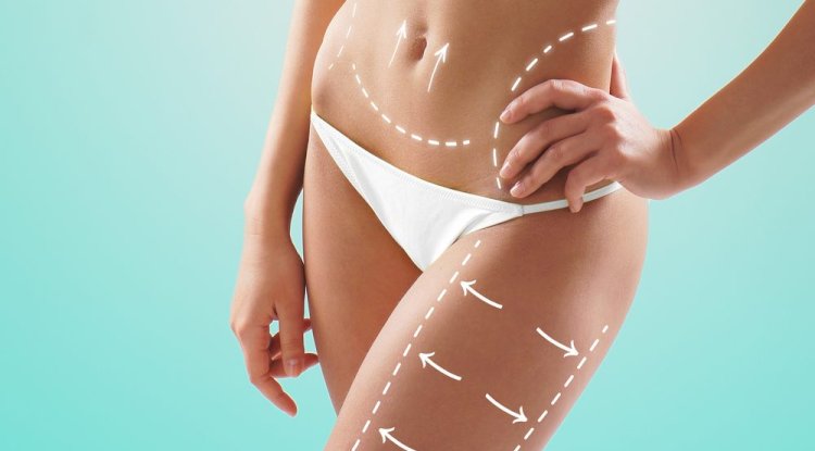 Tummy Tuck Pain Management Tips for a Comfortable Recovery