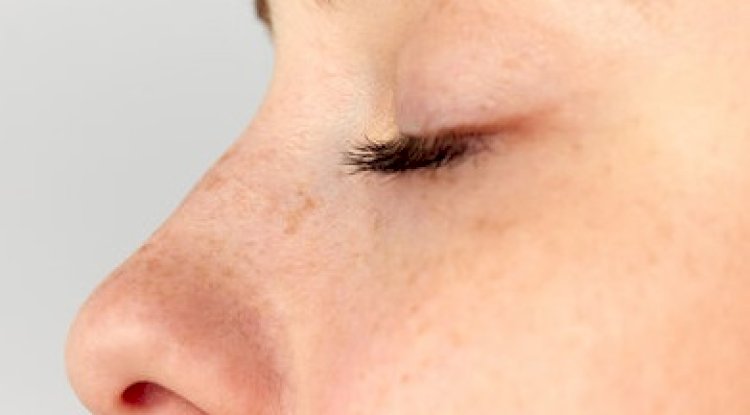 What is Rhinoplasty in Islamabad? A Complete Beginner’s Guide