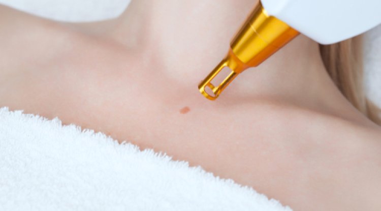 Effective Warts Removal Treatments That Actually Work Fast