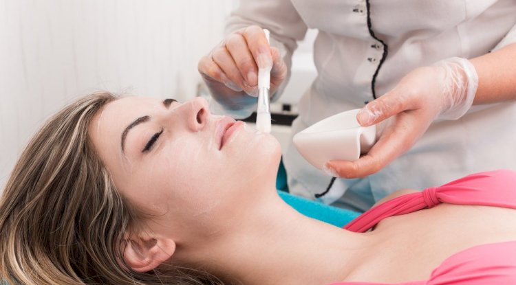 Chemical Peels in Islamabad: Success Stories