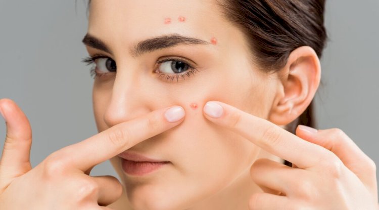 When Does Acne Treatment Dubai Show Real Results?