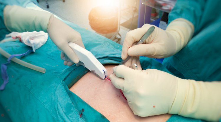 Establishing a Medical Stapler Manufacturing Plant Report 2025, Project Cost Details