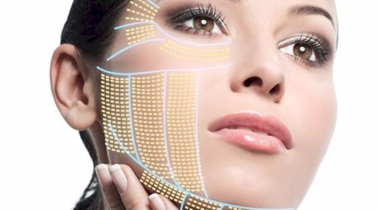 HIFU vs. RF (Radiofrequency): Which is More Effective in Islamabad?