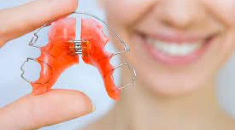How to Store Retainers Safely When Not in Use?