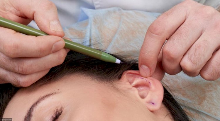 Latest Advancements in Ear Reshaping in Islamabad