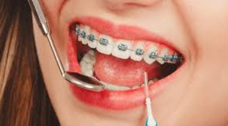 Tired of Searching "Orthodontist Close to Me"? Your Guide to Local Specialists Who Listen.