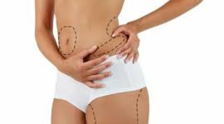 Liposuction in Delhi: What It Can Actually Do for Your Body
